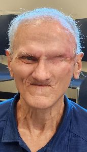 Photo of BURKS, DANNY MITCHELL