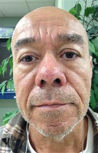 Photo of LANZARIN, ANTONIO