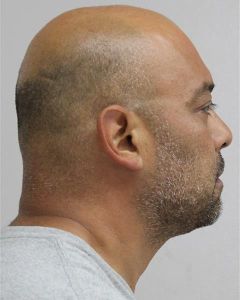 Photo of YZAGUIRRE, MICHAEL