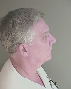 Photo of WINKLE, BARRY STEVEN