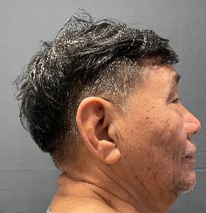 Photo of GONZALEZ-FUENTES, ARNOLDO